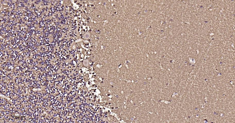 S100B蛋白重组兔单抗