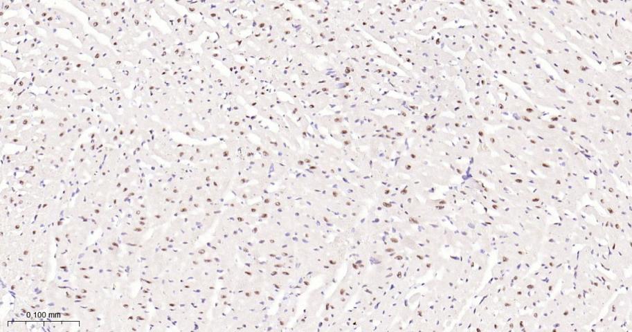 p53结合蛋白1重组兔单抗