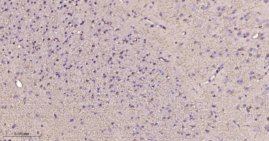 S100B蛋白重组兔单抗