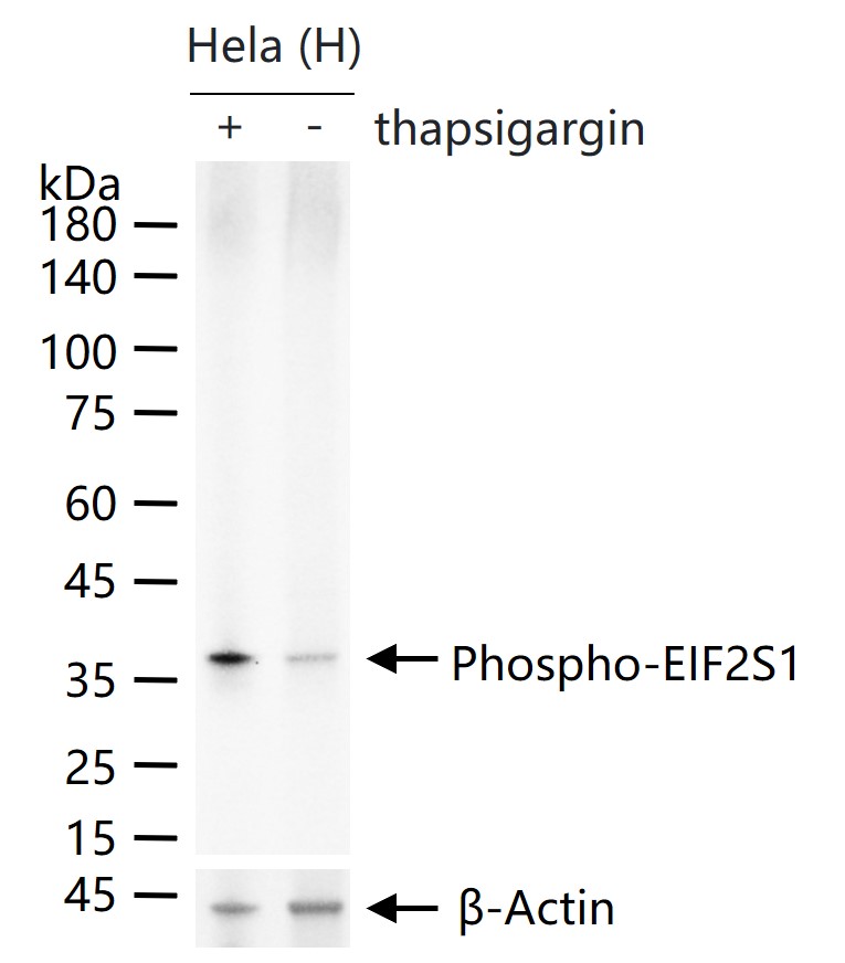 磷酸化真核启动因子2α抗体