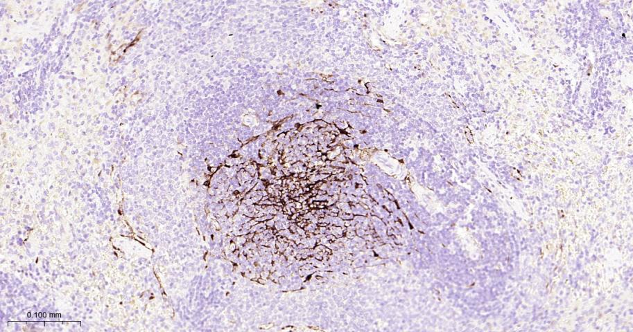 S100B蛋白重组兔单抗
