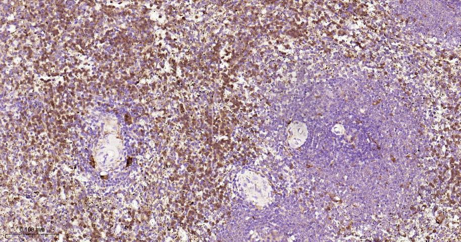 自噬相关蛋白7重组兔单抗