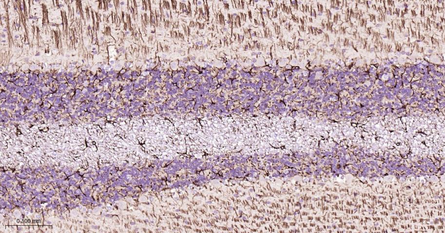胶质纤维酸性蛋白抗体-bs-0199R