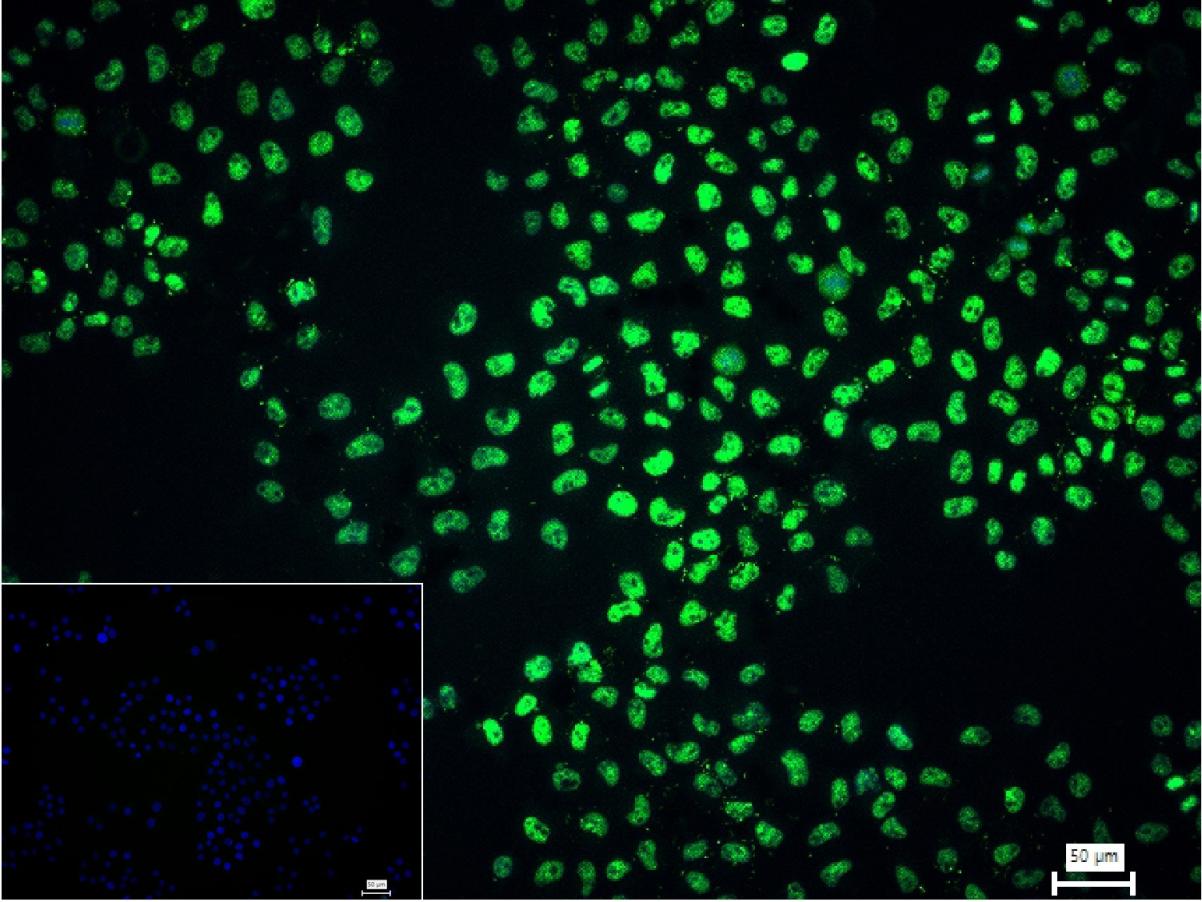 蛋白激酶B重组兔单抗