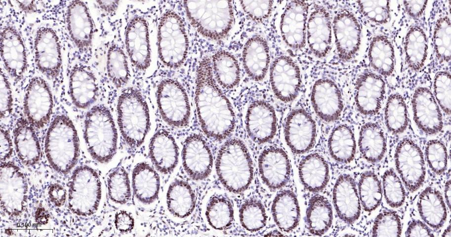 p53结合蛋白1重组兔单抗