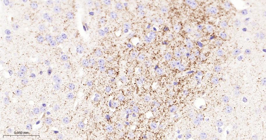 脱帽酶1A重组兔单抗