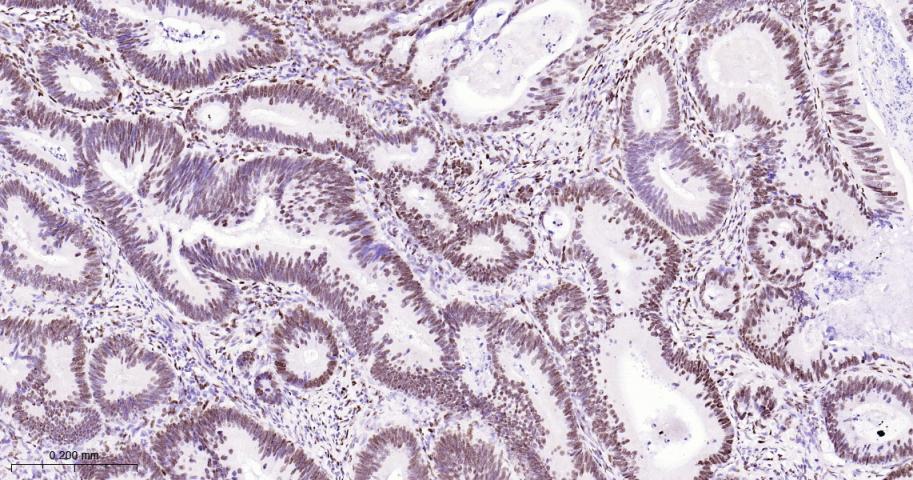 p53结合蛋白1重组兔单抗