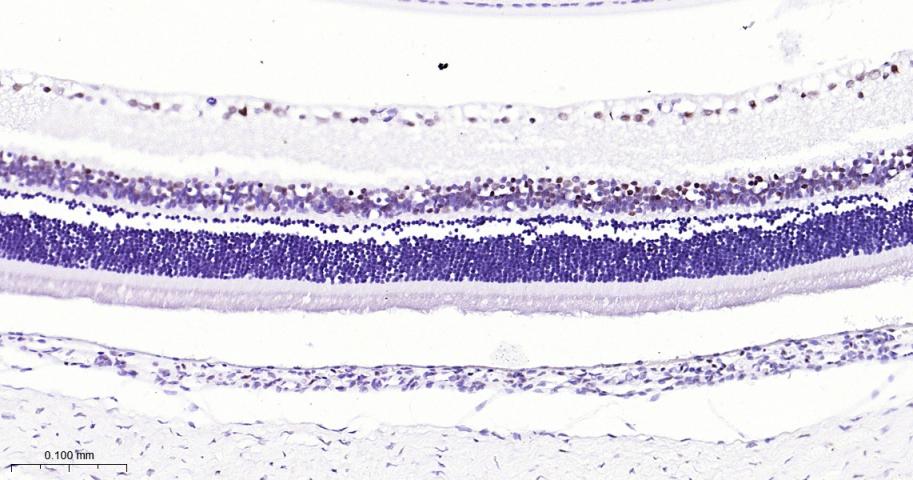 微小细胞血症相关转录因子重组兔单抗