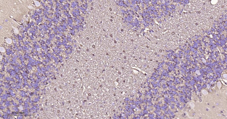 S100B蛋白重组兔单抗