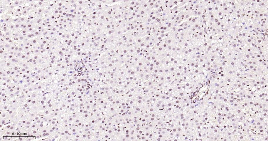 p53结合蛋白1重组兔单抗