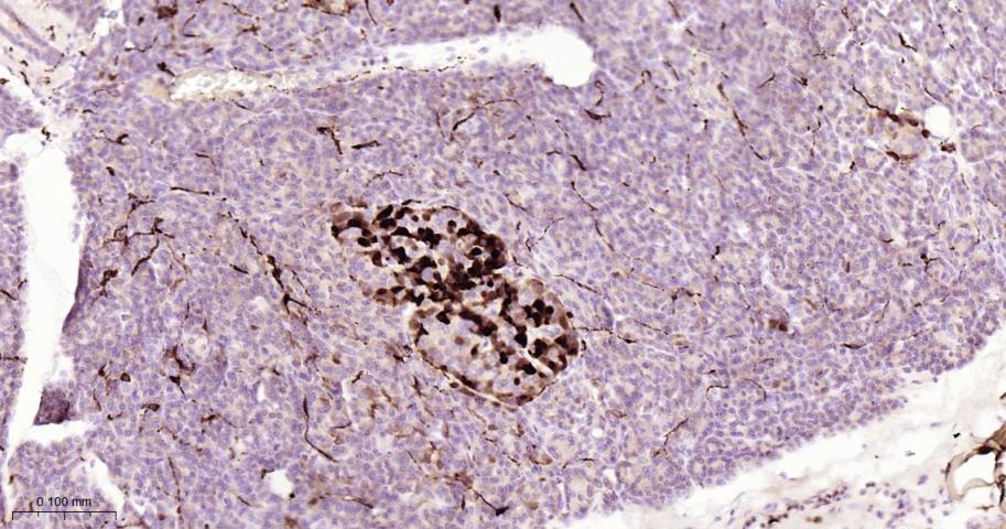 S100B蛋白重组兔单抗