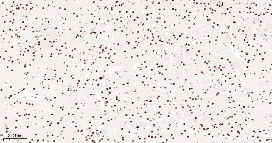 p53结合蛋白1重组兔单抗