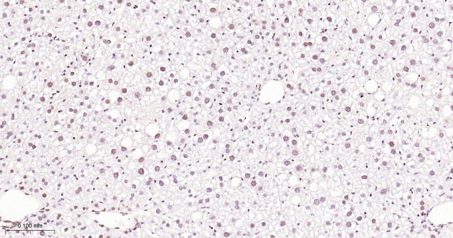 p53结合蛋白1重组兔单抗