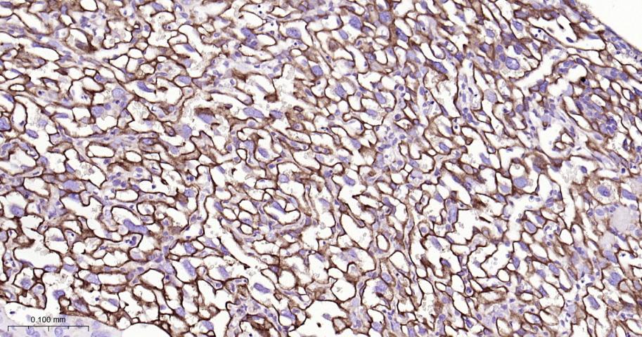 整合素α5（CD49e）重组兔单抗
