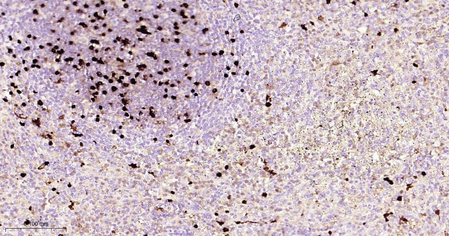 S100B蛋白重组兔单抗