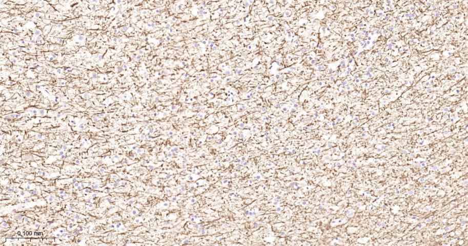 髓鞘碱性蛋白/磷脂碱性蛋白抗体-bs-24827R