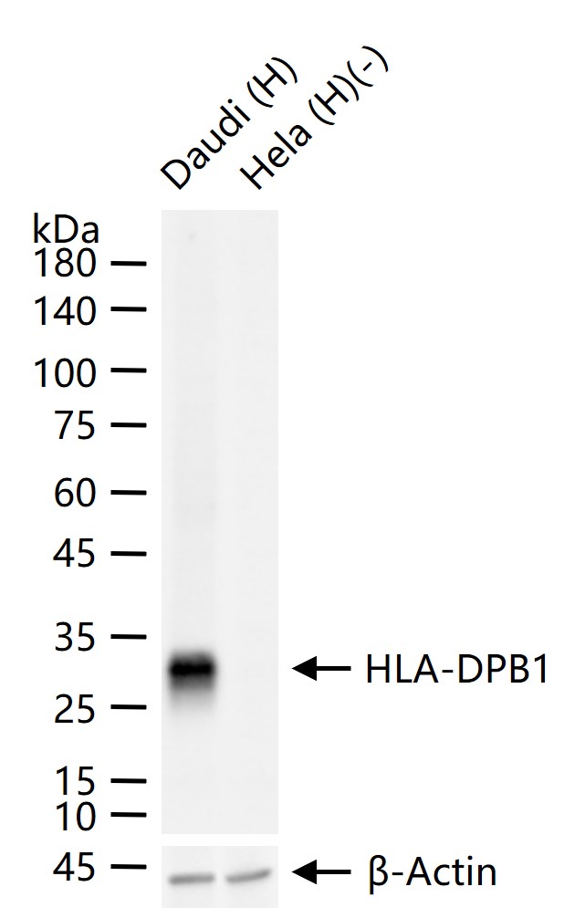 组织相容性复合体2重组兔单抗