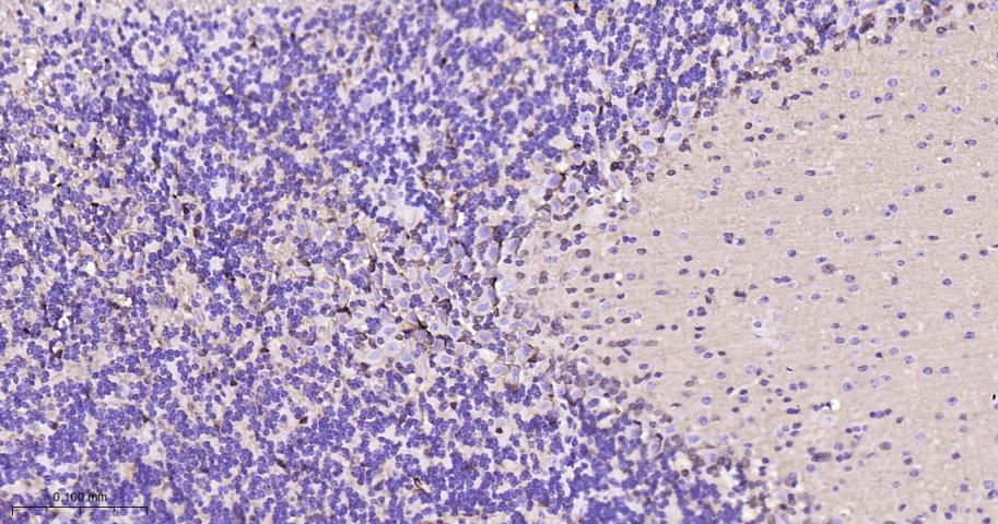 S100B蛋白重组兔单抗