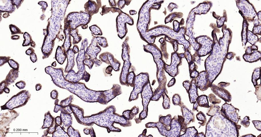 滋养层细胞糖蛋白5T4重组兔单抗