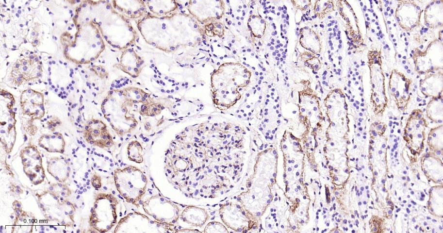 钙粘蛋白6重组兔单抗
