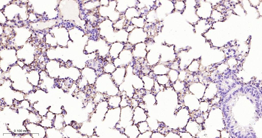 钙粘蛋白6重组兔单抗