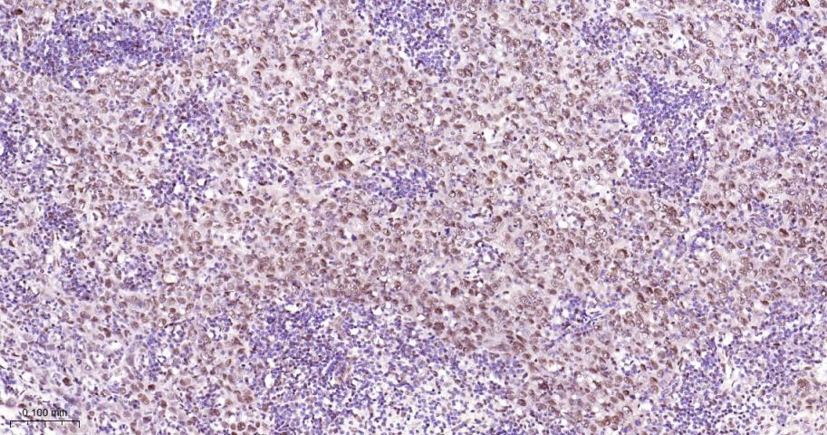 p53结合蛋白1重组兔单抗