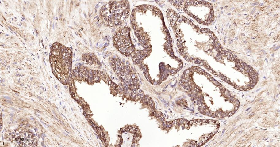 丝氨酸蛋白酶10重组兔单抗