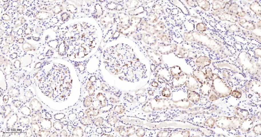 脱帽酶1A重组兔单抗