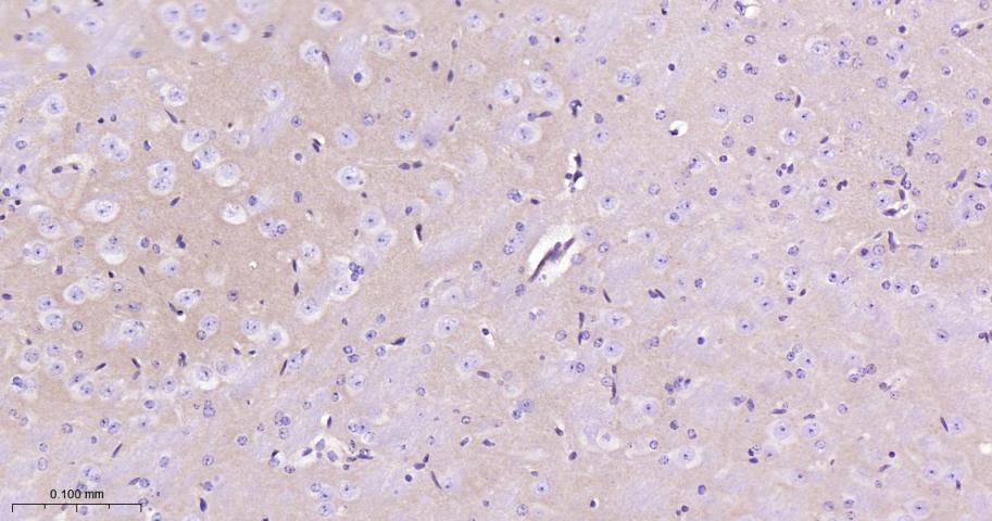 钙粘蛋白6重组兔单抗