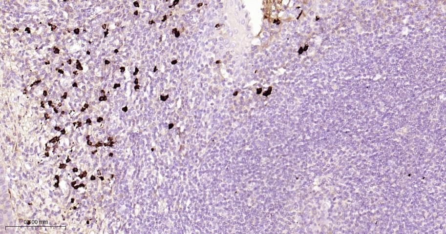 hIgG4重组兔单抗