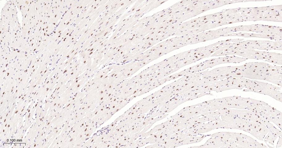 p53结合蛋白1重组兔单抗