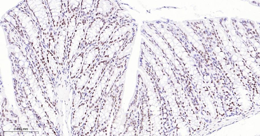p53结合蛋白1重组兔单抗