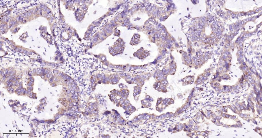 真核启动因子2α(eIFα2)兔单克隆抗体