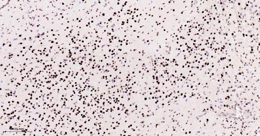 p53结合蛋白1重组兔单抗