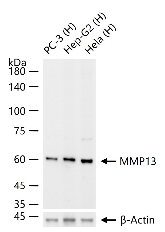 基质金属蛋白酶13重组兔单抗