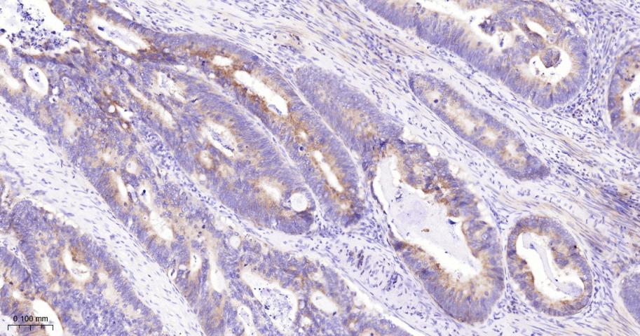 真核启动因子2α(eIFα2)兔单克隆抗体