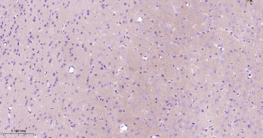 钙粘蛋白6重组兔单抗