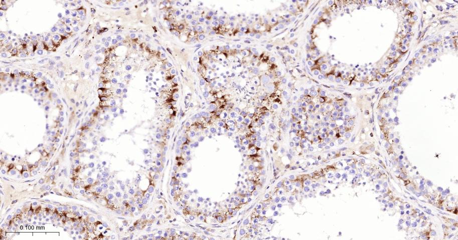 脱帽酶1A重组兔单抗