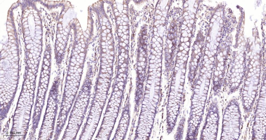 真核启动因子2α(eIFα2)兔单克隆抗体