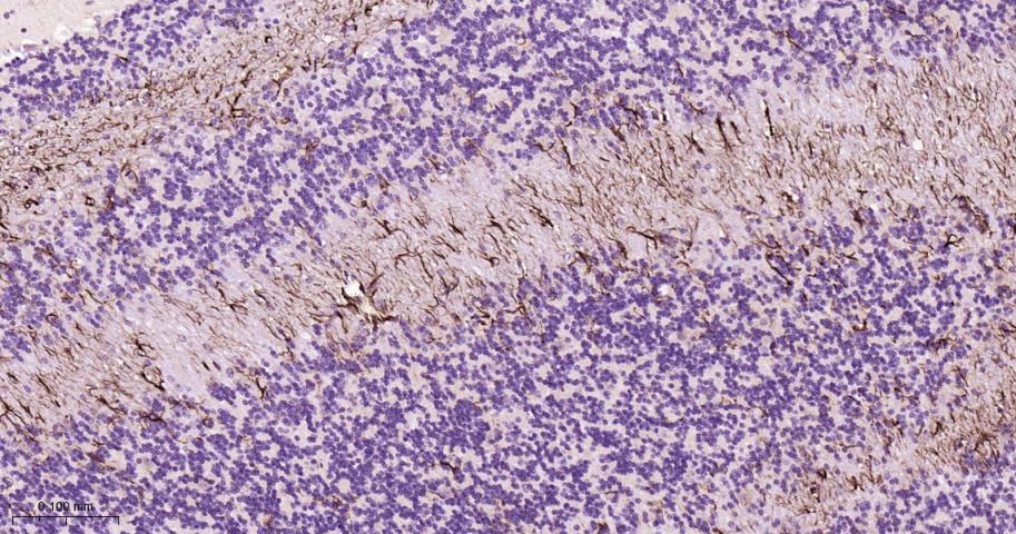 胶质纤维酸性蛋白抗体-bs-0199R