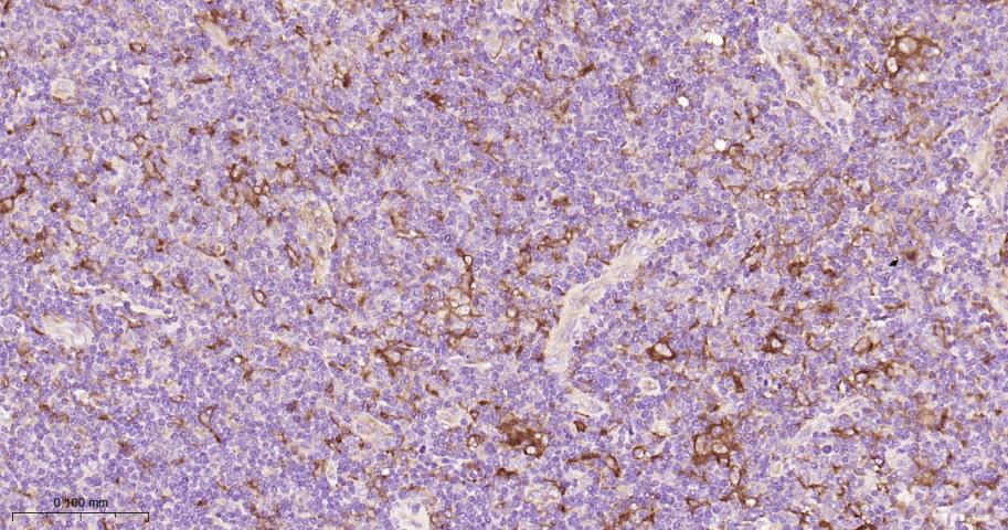 自噬相关蛋白7重组兔单抗