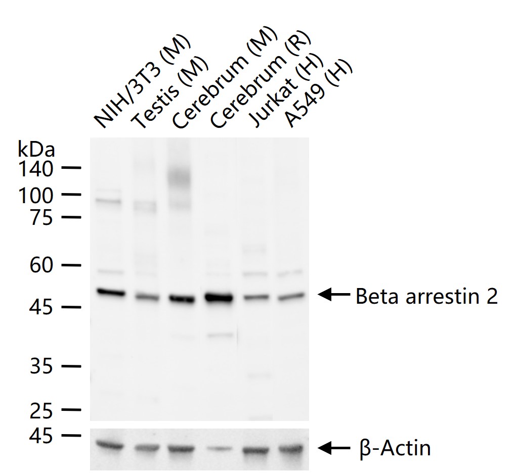 Beta arrestin 2 Rabbit pAb (一抗) - WB,IHC-P,IHC-F,IF | Bioss