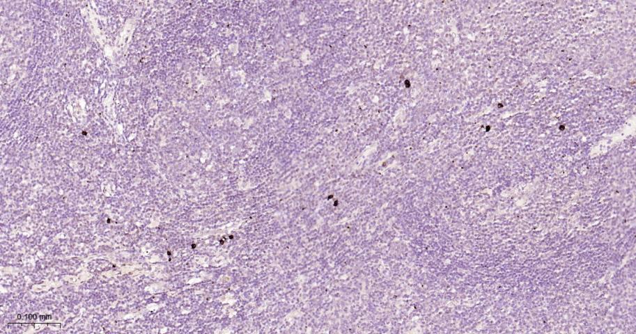 hIgG4重组兔单抗