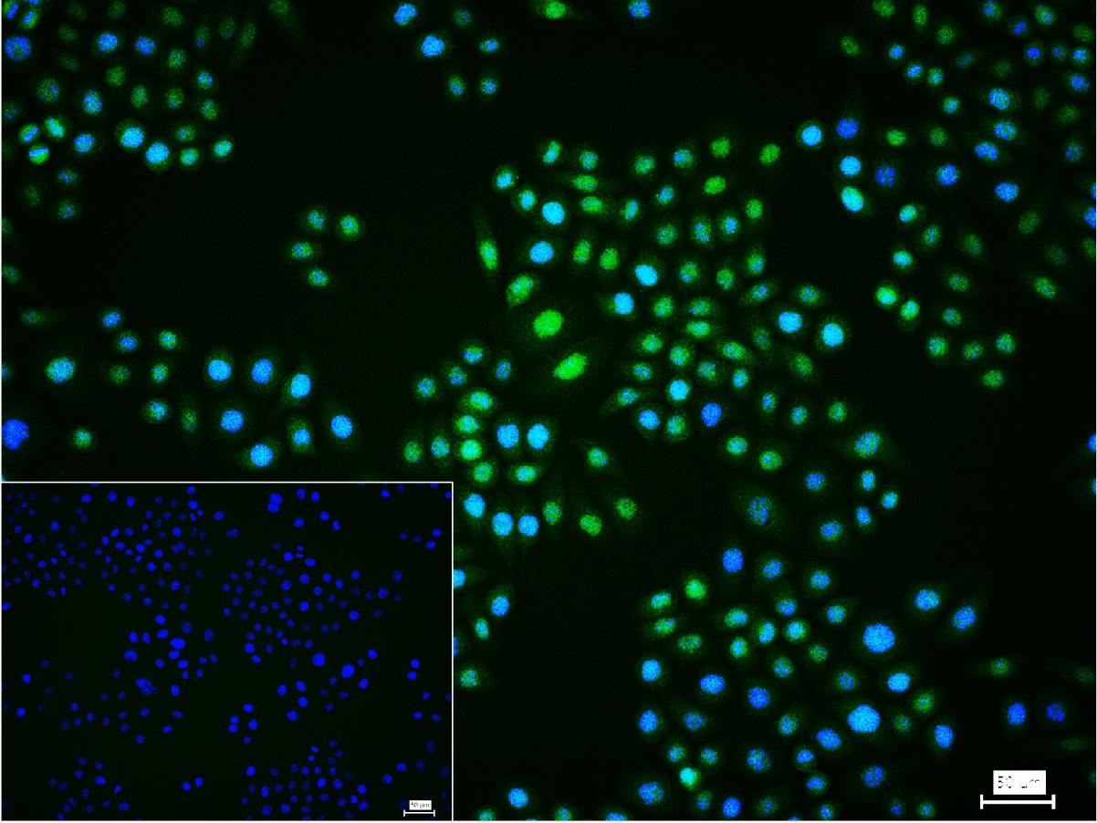 丝裂原活化蛋白激酶1/ERK 1/2重组兔单抗