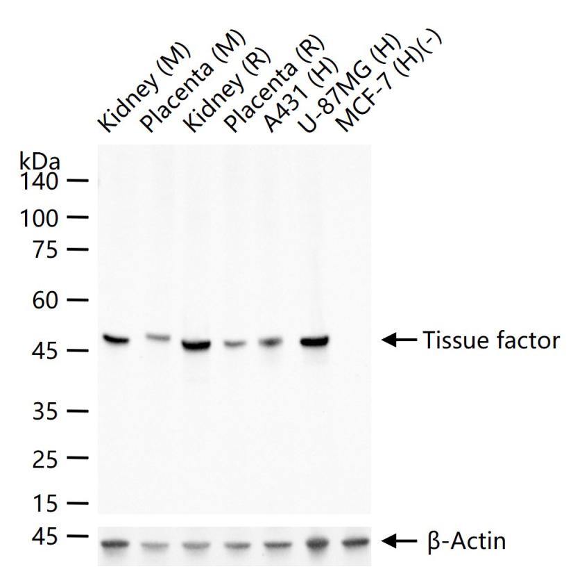 组织因子（CD142）兔单克隆抗体