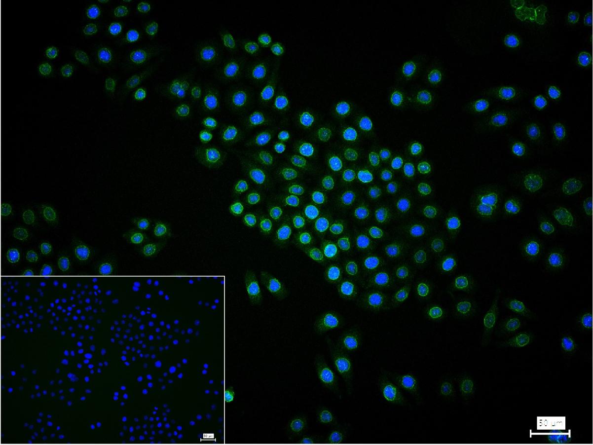 核纤层蛋白B重组兔单抗