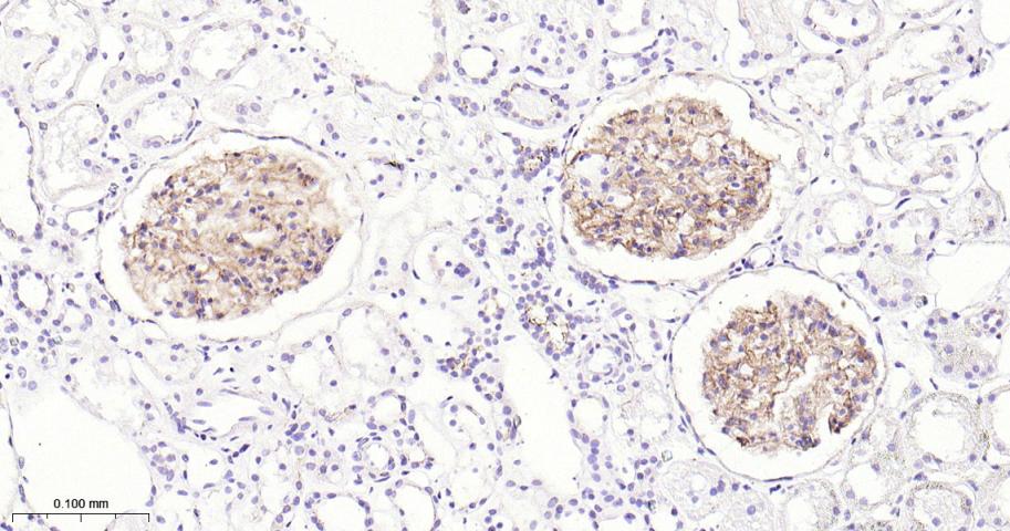 胞质紧密粘连蛋白1/闭锁小带蛋白1重组兔单抗