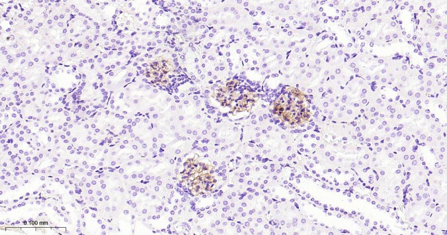 胞质紧密粘连蛋白1/闭锁小带蛋白1重组兔单抗