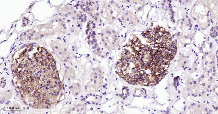 胞质紧密粘连蛋白1/闭锁小带蛋白1重组兔单抗