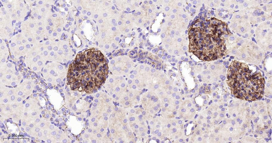 胞质紧密粘连蛋白1/闭锁小带蛋白1重组兔单抗